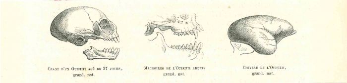 The Skull