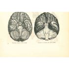 The Brain Of Human VS  The Brain Of Chimpanzee