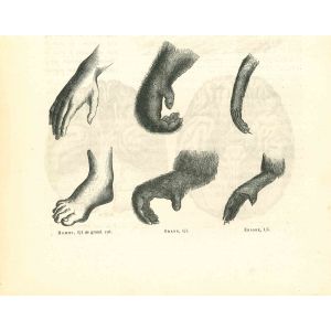 Comparison