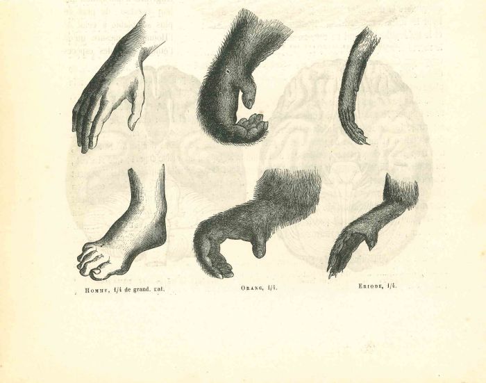 Comparison